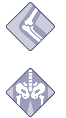 radiographie de la région pelvienne, montrant les hanches, la colonne vertébrale et les fémurs
